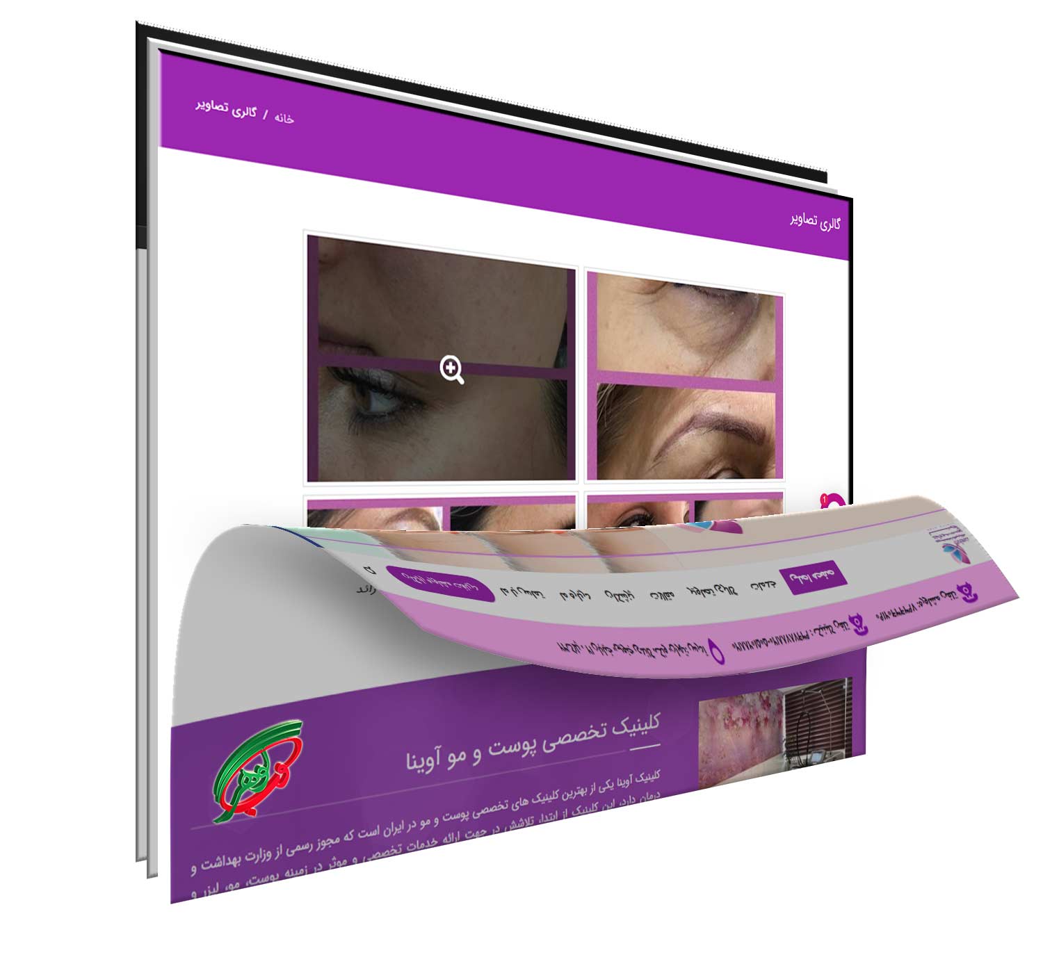 طراحی سایت کلینیک پوست و مو - گالری تصاویر قبل و بعد
