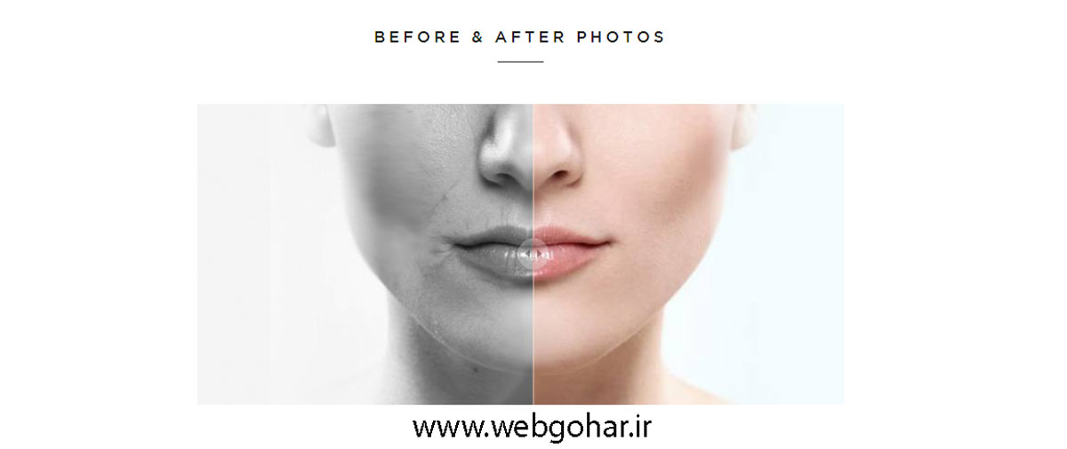 طراحی سایت کلینیک پوست و مو-تصاویر قبل و بعد